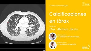 Calcificaciones en tórax por la Dra Melissa Arias Sáenz [upl. by Alexander62]