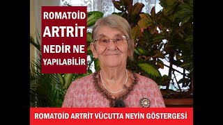 ROMATOİD ARTRİT VÜCUTTA NEYİN GÖSTERGESİ ROMATOİD ARTRİT HASTALARINA ŞİFA OLAN NE ÖĞRENMEK İSTEYEN [upl. by Asirehc598]