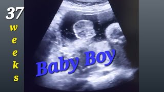 9 month pregnancy ultrasound  37 week scan  Posterior Placenta  Baby Boy or Girl  Baby heartbeat [upl. by Jayson]