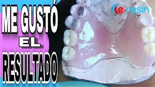 PRÓTESIS DENTAL FLEXIBLE CON E RESIN  Clip [upl. by Yasmar85]