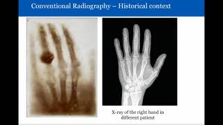 Introduction to Radiology Conventional Radiography [upl. by Islaen760]