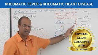 Pathogenesis of Rheumatic Fever  Rheumatic Heart Disease 🧑🏻‍⚕️ [upl. by Aneehsram]