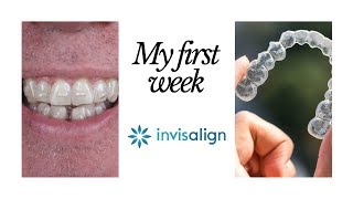 Invisalign Experience 1  Clear Braces Review of 1st week after getting Invisalign [upl. by Outhe]