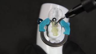 Easy obtention of a tight contact point using Palodent V3  SDR By Dr Andre Reis [upl. by Matelda]