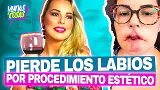 Famosa influencer pierde los labios tras someterse a procedimiento estético [upl. by Dlaregztif]