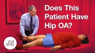 Does This Patient Have Hip Osteoarthritis [upl. by Anissej]