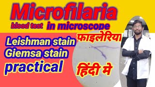 Microfilaria blood test hindi me II Leishman stain II Giemsa stain II microscope II microbiology [upl. by Aibsel]