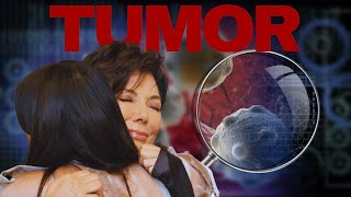 Kris Jenners Tumor Discovery Shocking Revelation [upl. by Doelling685]