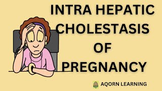 Intrahepatic Cholestasis of PregnancyICP  aqorn learning  rahat2021 [upl. by Ellette41]