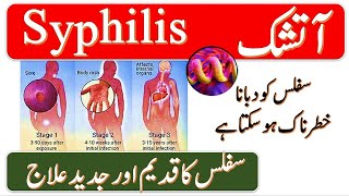 Syphilis epidemics prevention and treatment role of Homeopathy in Syphilis treatment HPathyRx [upl. by Savvas]