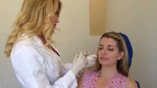 Dr Power injects filler on patient to lift cheeks and help with volume loss [upl. by Amber]