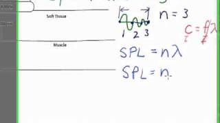 Ultrasound Physics Spatial Pulse Length SPL [upl. by Meluhs468]