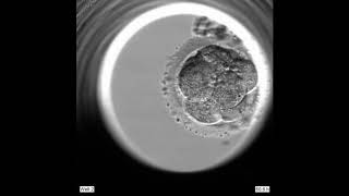 Blastocyst seen with EmbryoScope [upl. by Cohlier]