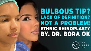 Bulbous tip Lack of Definition Not a Problem  Ethnic Rhinoplasty by Dr Bora Ok [upl. by Marras]