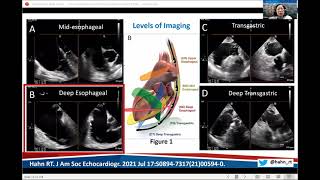 Part 1 Introduction to the Guidelines and Review of Aortic and Mitral Imaging [upl. by Ivey803]