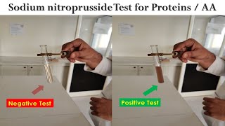 Sodium nitroprusside Test [upl. by Elke591]