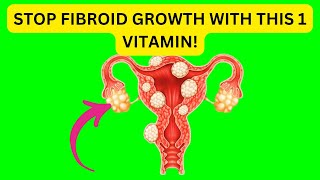 STOP Fibroid Growth with This 1 Vitamin [upl. by Akerdal73]