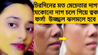 আলুর সাথে একটি জিনিস মিশিয়ে মাখো ত্বক দুধেরমত ফর্সাহবে Spotless glowing skinremove pigmentation [upl. by Nwahser790]