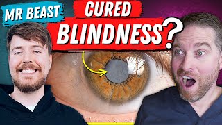 How MrBeast Helped Cure Blindness With Cataract Surgery [upl. by Neurath]