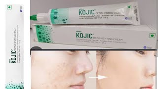 kojic cream use Glowing and white skin [upl. by Melnick]