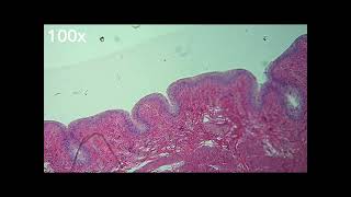 Analysis of a histological preparation Urinary bladder [upl. by Wiltz917]