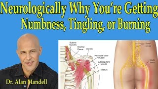 Neurologically Why Youre Getting NumbnessTingling or Burning in Arms or Legs  Dr Mandell [upl. by Trebloc]