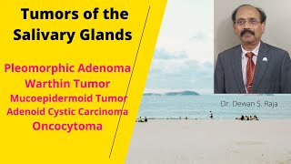 Salivary Gland Tumors [upl. by Davilman252]