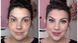 FULL COVERAGE Makeup for Melasma amp Discoloration [upl. by Leachim]