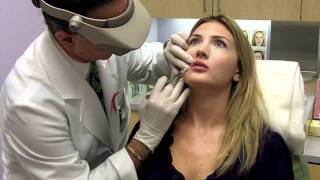 Juvederm Lip Filler  Total Dermatology [upl. by Tolliver]