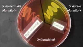 Selective and SelectiveDifferential Media Timelapse [upl. by Burleigh2]