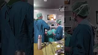 Cholecystectomy Surgery [upl. by Rhiamon]