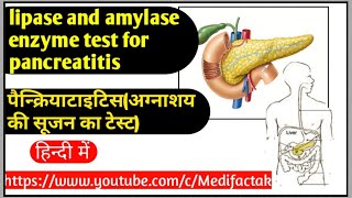 Lipase and amylase enzymes test for pancreatitisपैन्क्रियाटाइटिसअग्नाशय की सूजन का टेस्ट [upl. by Dehsar301]