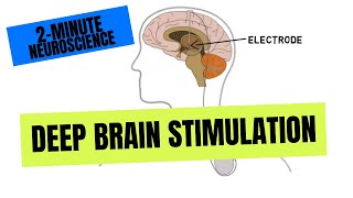 2Minute Neuroscience Deep Brain Stimulation [upl. by Sivehc]