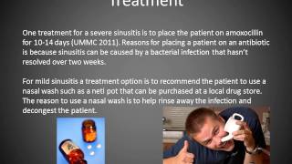 Maxillary Sinusitis [upl. by Court747]