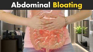 What Happens in Abdominal Bloating  Symptoms Causes And Treatment [upl. by Enahpets169]