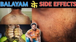 Balayams Side Effect amp BenefitsAvoid mistake in Balayam How To Do Balayam Need hair transplant [upl. by Noivart]