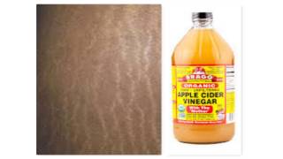 FADING STRETCH MARKS WITH APPLE CIDER VINEGAR [upl. by Ahsema]