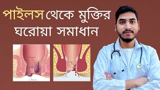 পাইলস থেকে মুক্তির ঘরোয়া সমাধান  Hemorrhoids  Dr Jahidul Islam piles hemorrhoids [upl. by Haidebez331]