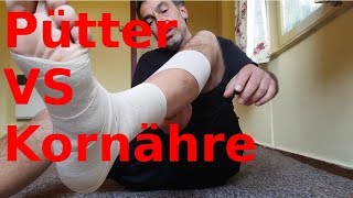 Pütter vs Kornähre  Joggen mit Kompressionsverband Pflege [upl. by Meelak754]