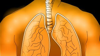 Displasia broncopulmonar [upl. by Sarajane668]