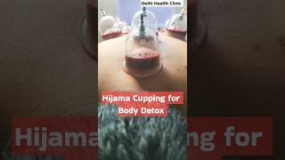 Blood Purification amp Detox Secrets Power of Hijama Cupping hijama cupping detox [upl. by Paton]