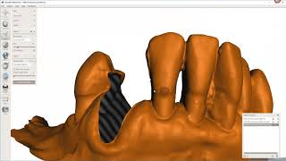 Advance Virtual Tooth Extraction [upl. by Derfniw]