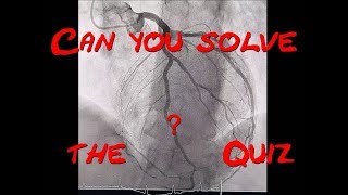 What are the Patient´s problems Echocardiography and Coronary angiogram Quiz by Cardiology Forum [upl. by Brittnee]