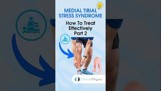 Treating Medial Tibial Stress Syndrome Pt 2 Exercises physicaltherapy physiotherapy shinsplints [upl. by Neltiac]