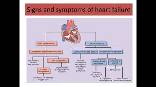 treatment of Congestive heart failure part 1 2024 [upl. by Odlavu540]