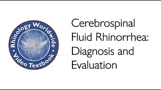 Cerebrospinal Fluid Rhinorrhea Diagnosis and Evaluation  Dr Donald Lanza and Dr Alla Solyar [upl. by Georgiana]