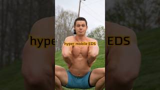 Hypermobile EDS whealth stayflexy [upl. by Altaf]