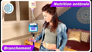 Branchement à domicile de la nutrition entérale sur sonde de gastrostomie PEG [upl. by Ahsilav]