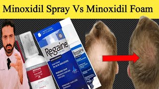 Minoxidil 5 Spray  Minoxidil 5 Foam  Minoxidil Spray Vs Minoxidil Foam  Avogain 5 Spray [upl. by Aleik]