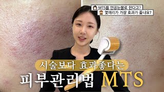 요즘 핫한 셀프MTS 부작용은 없는데 효과 배로 보는법 [upl. by Lucey552]